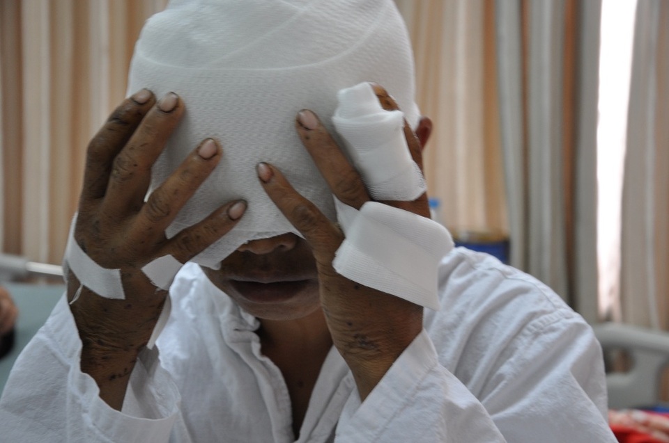 Kể lại chuyện mình bị gấu tấn công, anh Ký còn nguyên cảm giác sợ hãi.