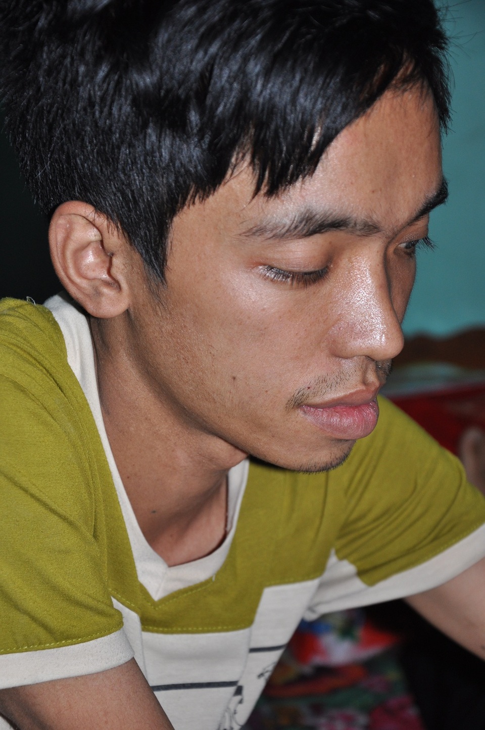 Tùng bị ung thư trung thất đã mấy năm và 1 vài lần được lên bệnh viện Bạch Mai xạ trị.