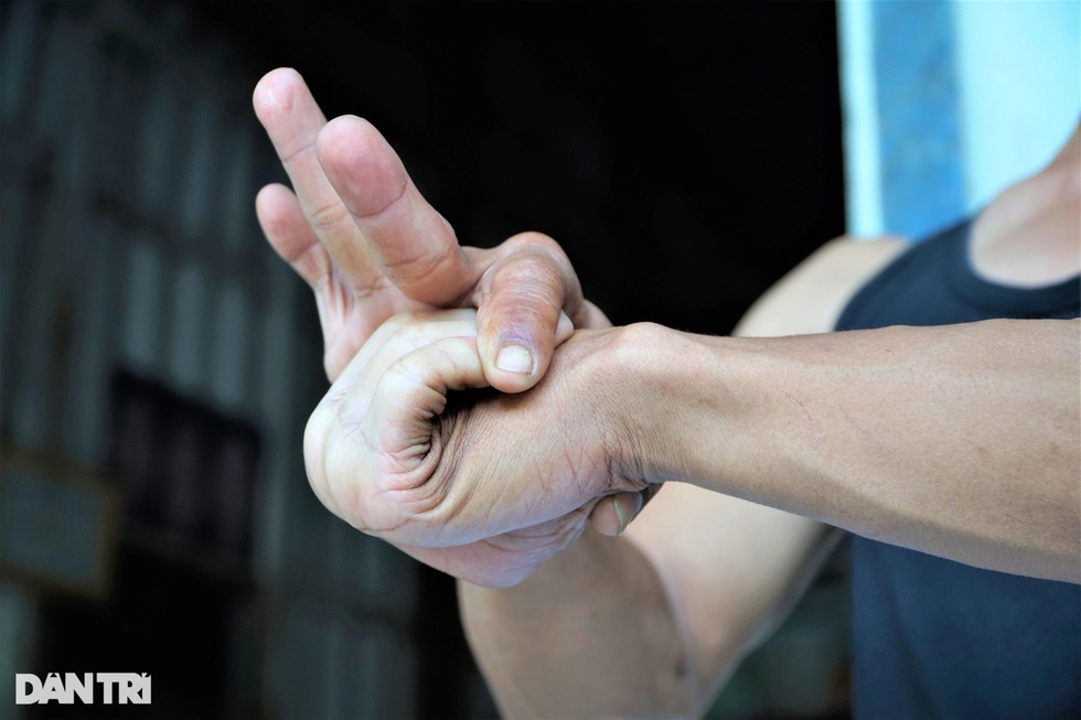 Người đàn ông miền Tây có làn da kéo giãn như cao su tay chân bẻ gập 180 độ - 10