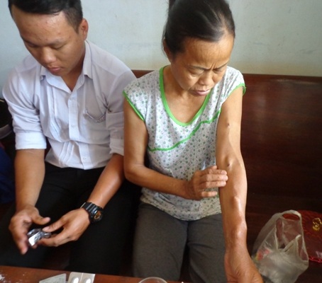 Cánh tay
sưng, phù vì bệnh tật của mẹ Hiếu