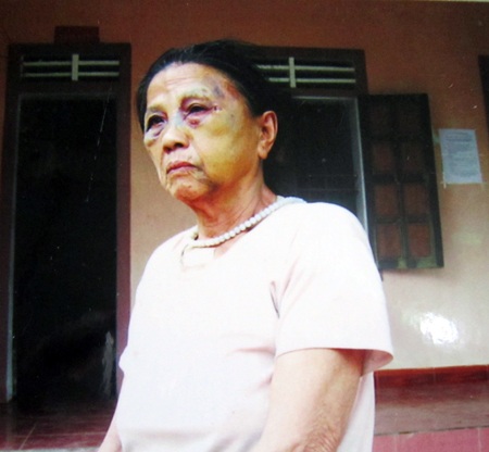 Cụ bà 70 tuổi bị một thanh niên bóp cổ, đánh bầm mặt - 3