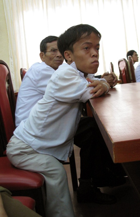 Chất độc da cam... nỗi đau dài chưa dứt - 1 Những đứa trẻ mang di chứng chất độc da cam...