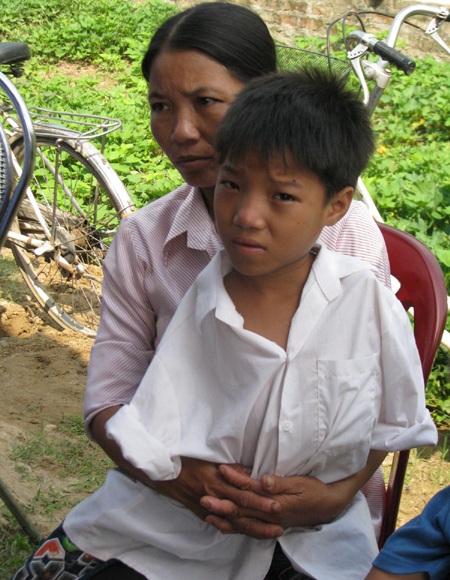 rồi cũng có em hai tay cụt..