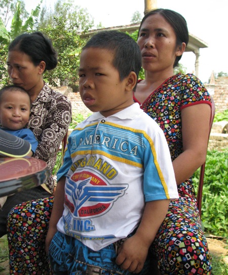 hoặc chuyển sang một thứ bệnh khác...