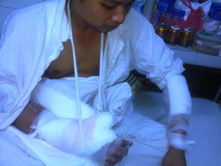 Anh Hoàng Văn Trung bị trọng thương đang được điều trị tại Bệnh viện Việt - Đức, Hà Nội.