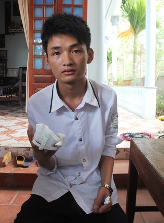 Mặc dù bị thương nhưng Lực vẫn cố gắng ôn thi và quyết tâm thi đỗ tốt nghiệp 