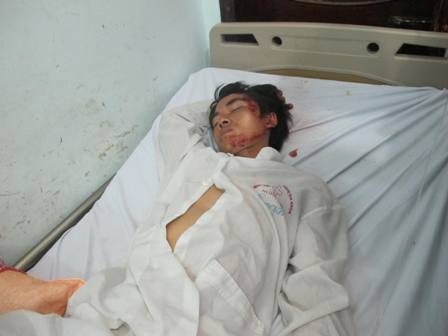 Nạn nhân sống sót bàng hoàng nhớ lại vụ lật xe ở Lào