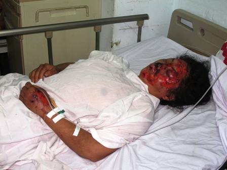 Nạn nhân sống sót bàng hoàng nhớ lại vụ lật xe ở Lào