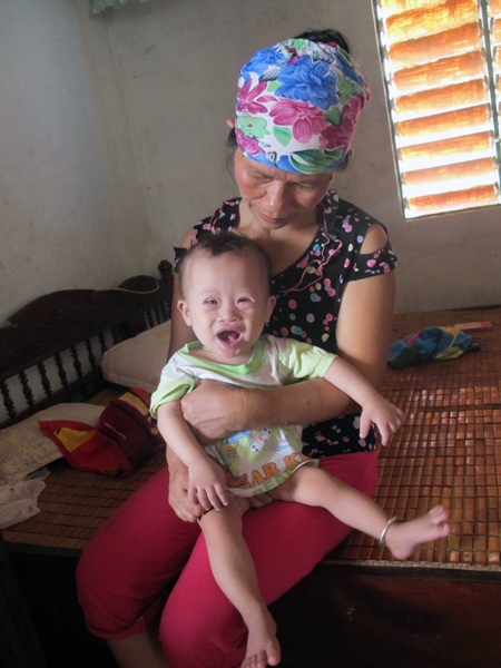 Xót lòng bé 11 tháng tuổi thoi thóp vì chứng bệnh down và tim bẩm sinh phức tạp - 2 Xót lòng bé 11 tháng tuổi thoi thóp vì chứng bệnh down và tim bẩm sinh phức tạp