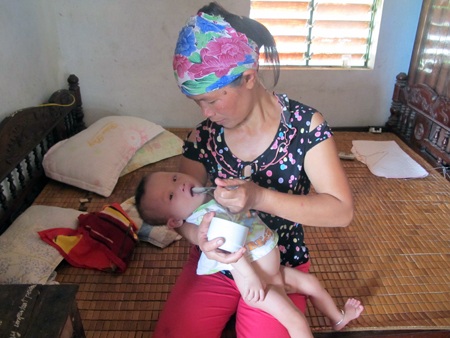Xót lòng bé 11 tháng tuổi thoi thóp vì chứng bệnh down và tim bẩm sinh phức tạp - 3 Bé Phúc Huy bị hở vòm miệng nên không thể bú, mà chỉ ăn được từng thìa sữa ngoài.