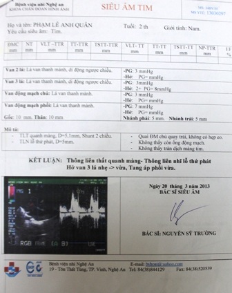 Kết quả siêu âm tim của bé Quân bị thông liên thất, thông liên nhĩ và hở van ba lá.