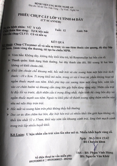 Kết quả chụp cắt lớp vi tính của Bệnh viện Ung bướu Nghệ An cho Gồ.
