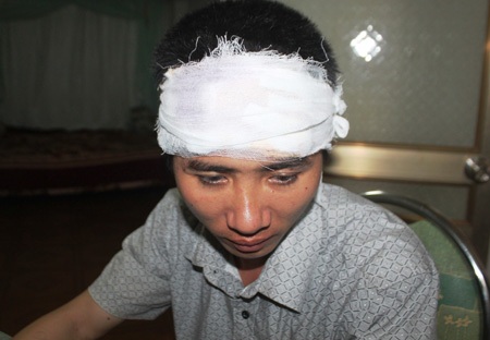 Anh Anh bị thương sau khi nhóm côn đồ truy sát trong đêm