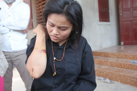 Chị Mai bị thương sau vụ tai nạn nhưng con gái chị đã mất mạng