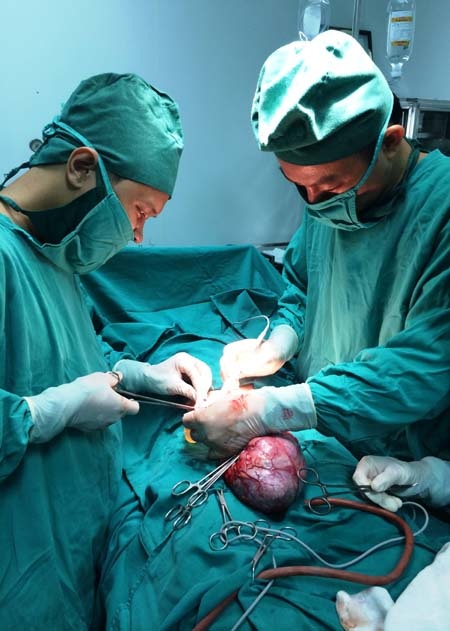Các bác sĩ tiến hành phẫu thuật cắt bỏ khối u buồng trứng nặng hơn 6kg