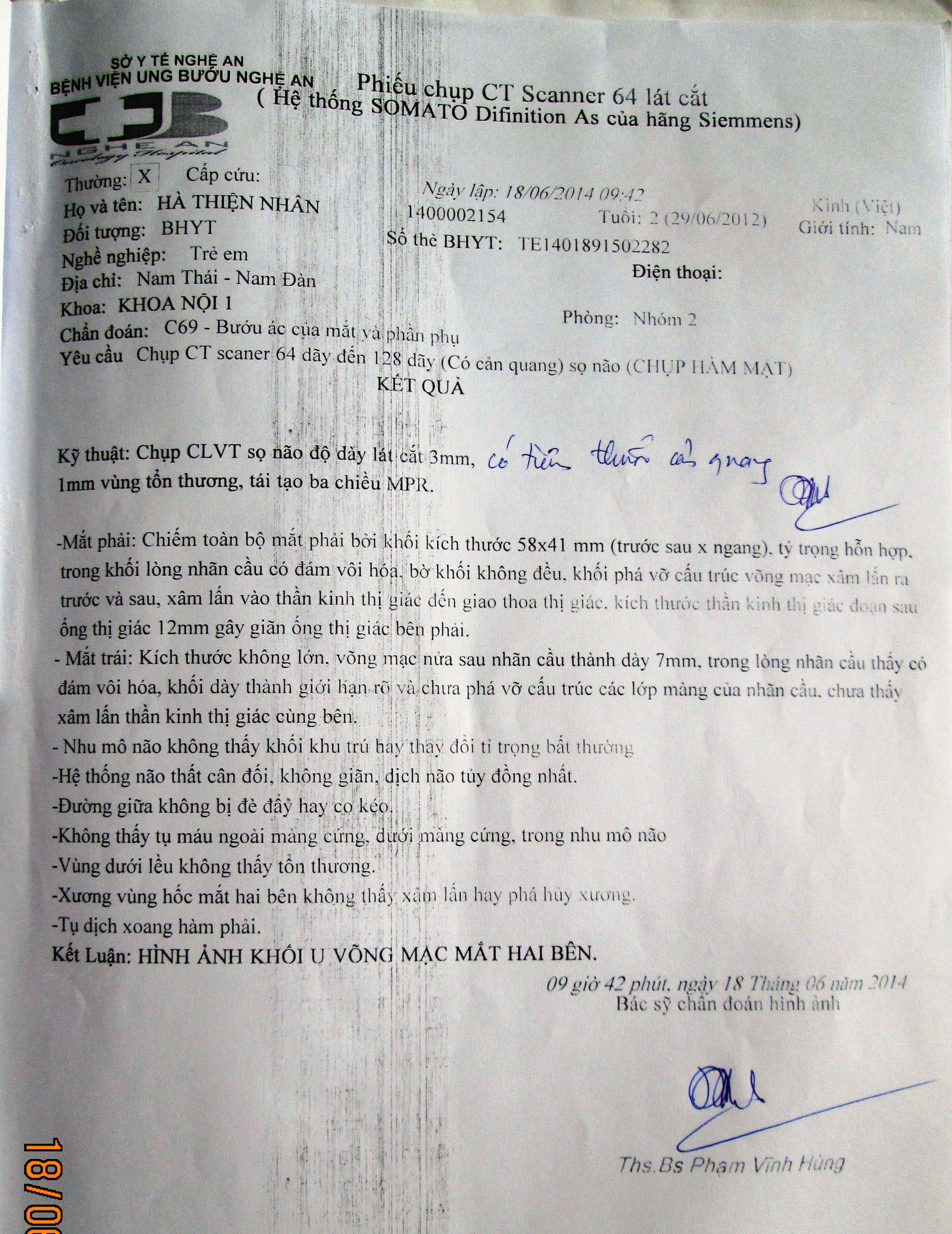 Kết quả chụp cắt lớp của bé Thiện Nhân