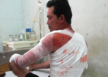 Hiện trường vụ nổ lò luyện thép khiến 2 người tử vong, 2 người bị thương