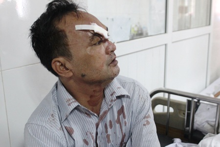 Ông Nguyễn Quang Đồng (SN 1955) nhớ lại giây phút hai chiếc xe đối đầu nhau 