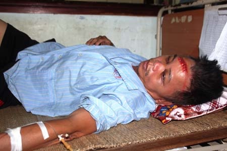 Ông Nghị bị vết thương trên trán phải khâu 7 mũi