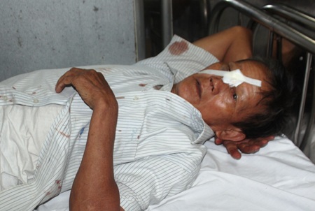 Nhiều nạn nhân bị thương sau vụ tai nạn vẫn chưa hết bàng hoàng về vụ tai nạn