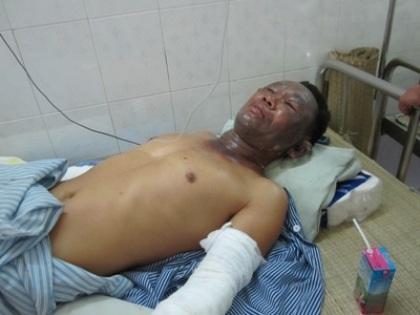 Nổ lớn tại công ty đóng tàu, 5 công nhân trọng thương - 1