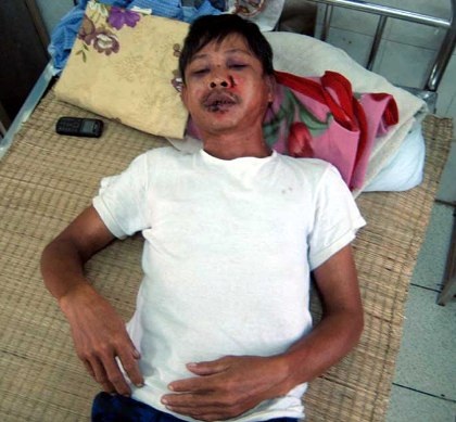 Công an viên bị đánh gãy xương sườn khi làm nhiệm vụ - 1 Công an viên bị đánh gãy xương sườn khi làm nhiệm vụ - 1