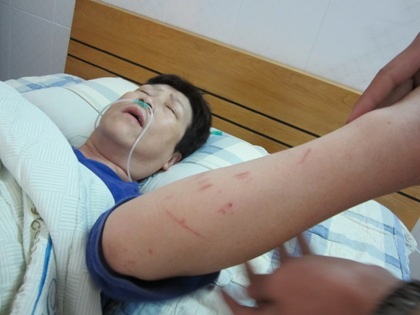 Bà Chen Ming Yu chưa hết bàng hoàng sau vụ tai nạn kinh hoàng.