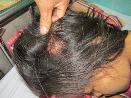 Giấy triệu tập 