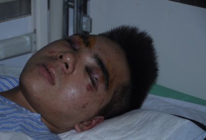 Nam sinh viên bị “ma cũ” đánh dã man giữa ký túc xá - 1 Sinh viên Thái Duy Mạnh đang phải điều trị tại bệnh viện Xanh Pôn trong tình trạng nguy kịch.