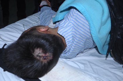 Nam sinh viên bị “ma cũ” đánh dã man giữa ký túc xá - 2 Những kẻ côn đồ dùng hung khí đánh hội đồng gây thương tích vùng đầu nạn nhân.