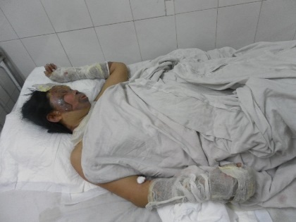 Các nạn nhân đang hết sức nguy kịch.