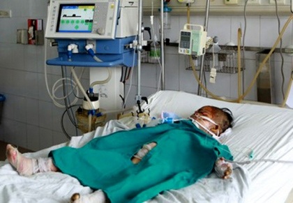 3 mẹ con chị Nguyễn Thị Luyến đang được cấp cứu tại Viện Bỏng quốc gia trong tình trạng nguy kịch.