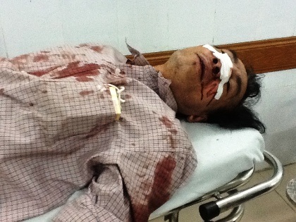 Đang ở trong nhà cùng 2 chiến sĩ công an, anh Trịnh Quốc Tuấn vẫn bị nhóm côn đồ truy sát dã man.