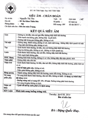 Hà Nội: Phẫu thuật xong nhiều ngày tá hỏa phát hiện bị cắt mất một bên thận - 1 Kết quả siêu âm của bệnh nhân T tại BV đa khoa Thiên Đức.