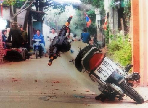 Anh Nguyễn Xuân Bắc với tình trạng đa chấn thương sau khi bị hành hung.