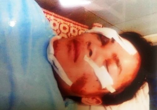 Anh Nguyễn Xuân Bắc với tình trạng đa chấn thương sau khi bị hành hung.