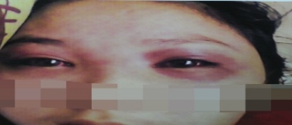 Hà Nội: Thiếu nữ phố núi bị cưỡng bức, rạch tay khẩn thiết kêu cứu - 1 Thiếu nữ phố núi bị cưỡng bức, rạch tay khẩn thiết kêu cứu.