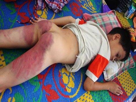 Nhiều trẻ em đang phải chịu bạo hành trong gia đình