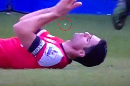 Cận cảnh cú ngã bay răng của Arteta