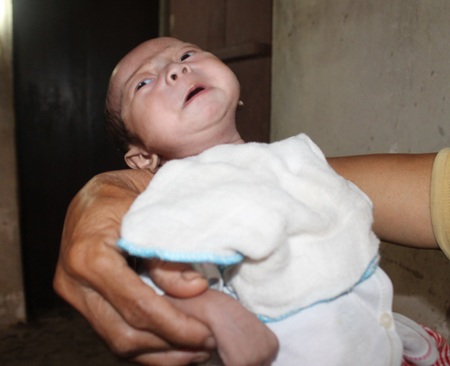 Sự sống mong manh của bé 3 tháng tuổi mắc bệnh tim bẩm sinh nặng - 1 Sự sống mong manh của bé 3 tháng tuổi mắc bệnh tim bẩm sinh nặng