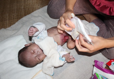 Sự sống mong manh của bé 3 tháng tuổi mắc bệnh tim bẩm sinh nặng - 2 Sự sống mong manh của bé 3 tháng tuổi mắc bệnh tim bẩm sinh nặng