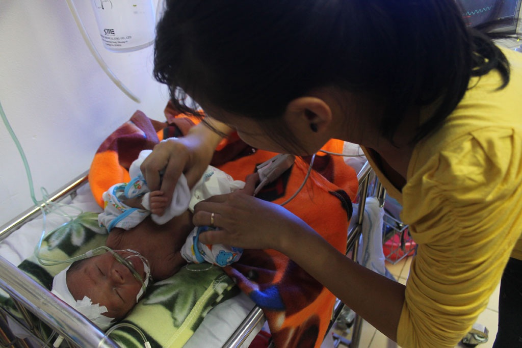 Mong manh sự sống của cháu bé sinh non bị giãn não thất - 5 Thằng bé cố nắm lấy tay mẹ như níu giữ sự sống của chính mình.