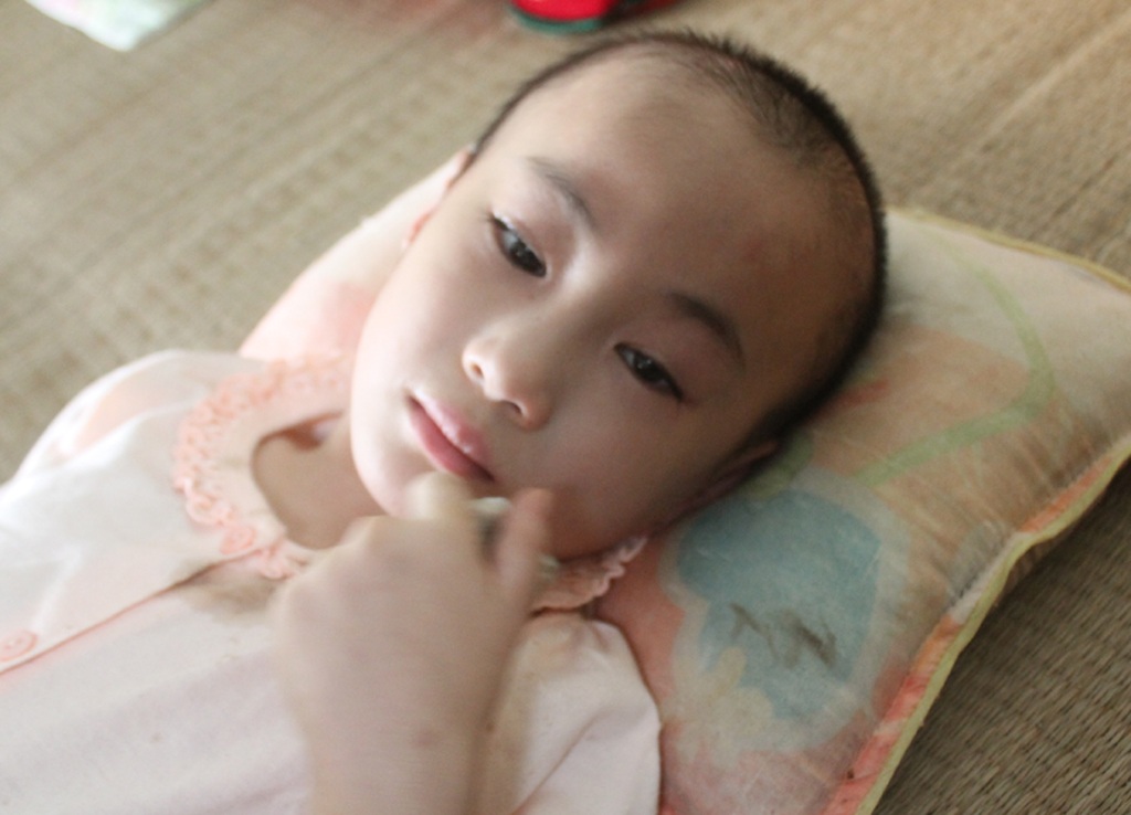 Rơi nước mắt trước nụ cười bé 7 tuổi ung thư não giai đoạn cuối - 2 Trong những phút tỉnh tảo, Yến Nhi vẫn nở nụ cười dù mỗi cử động miệng của em đã rất khó khăn.