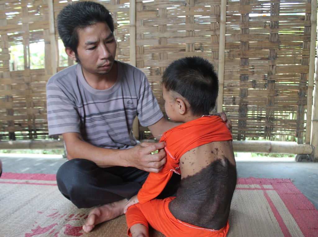 ... Người bé bị bao phủ bởi lớp da đen, sần sùi, mọc lông.