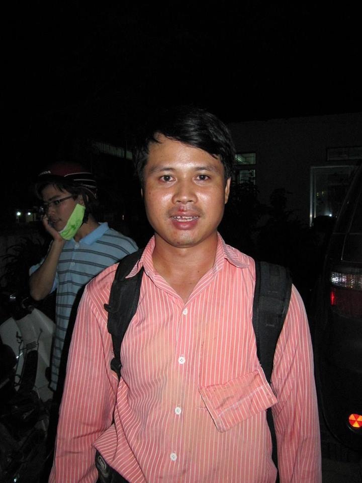 Dọc đường tác nghiệp và những câu chuyện cười ra nước mắt - 4 Nhà báo Đắc Lam sau khi được đồng nghiệp sơ cứu.