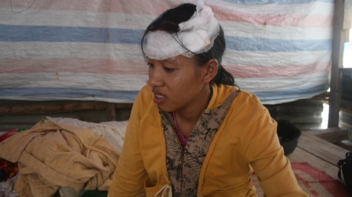 Nhiều công nhân bị đánh trong đêm - 1