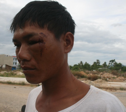 Nhiều công nhân bị đánh trong đêm - 2