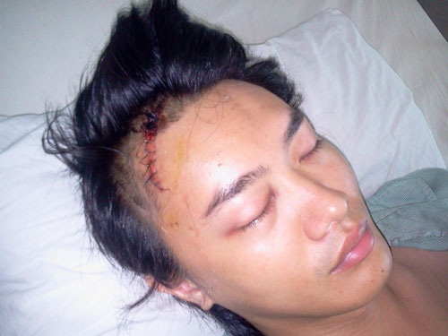 Ca sĩ Tuấn Khanh bị đánh vỡ sọ: Do băng nhóm đòi “bảo kê”? - 1 Ca sĩ Tuấn Khanh bị đánh vỡ sọ: Do băng nhóm đòi “bảo kê”? - 1