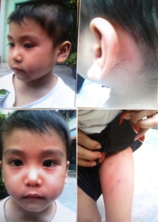 Bé trai bị dì ruột đánh đập, bỏ đói, nhốt vào nhà tắm  - 2