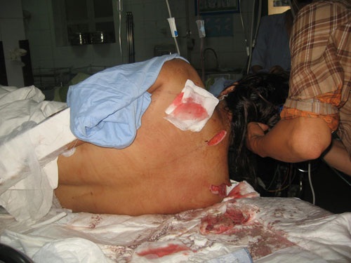 Kẻ si tình hành hung cô giáo dã man  - 2